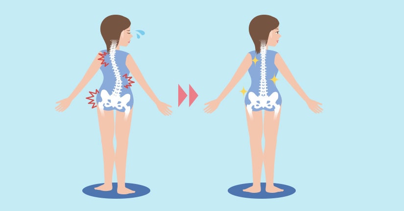 5 Cara Menghindari Skoliosis dari Kebiasaan Sehari-hari